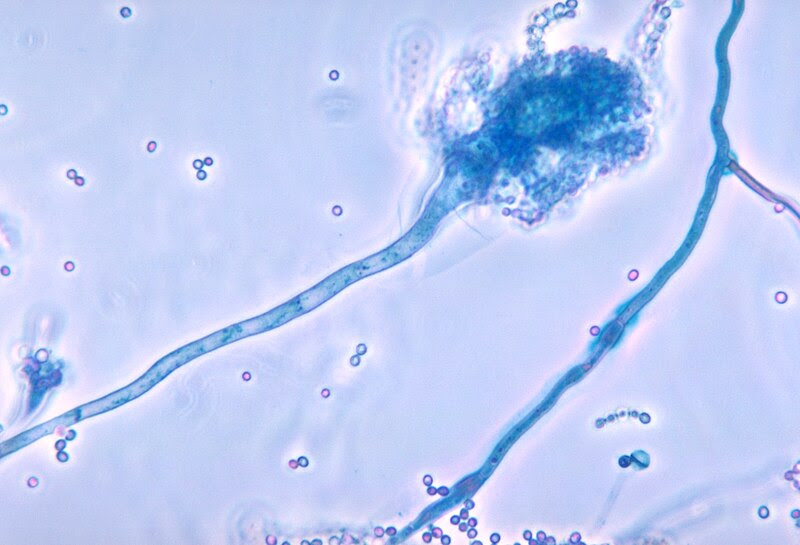 Archivo: Aspergillus fumigatus 01.jpg