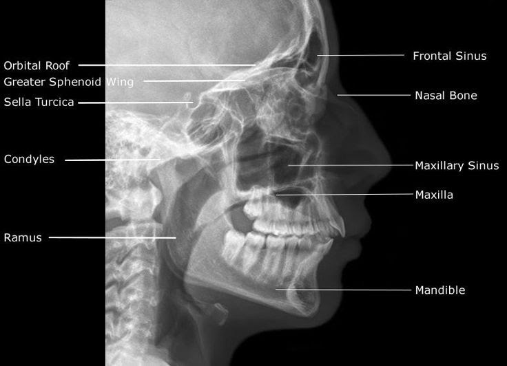 How Many Bones In The Face And Head : Orbicularis Oculi muscle, origin