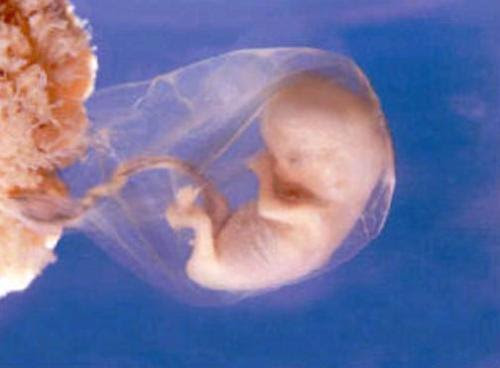 Preg-9