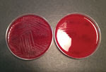 Thumbnail of Blood agar plates with (left) and without (right) pyridoxal supplement from a study of neonatal Granulicatella elegans bacteremia, London, UK.