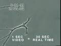 Footage of Mercury Withering Neuron by Univ of Calgary
