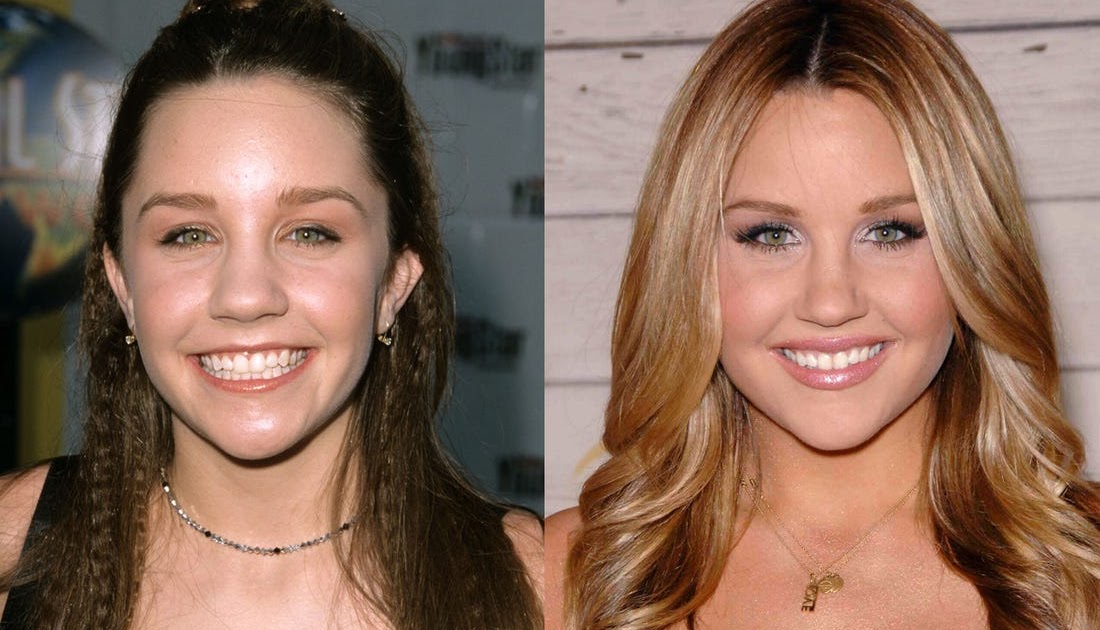 Amanda Bynes Then Vs Now / 21 Child Celebrities Then And