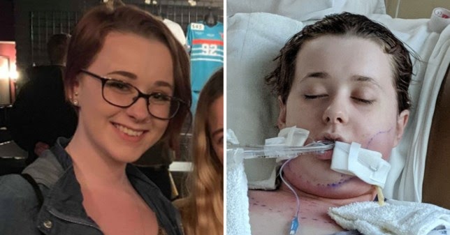 sepsis vomiting