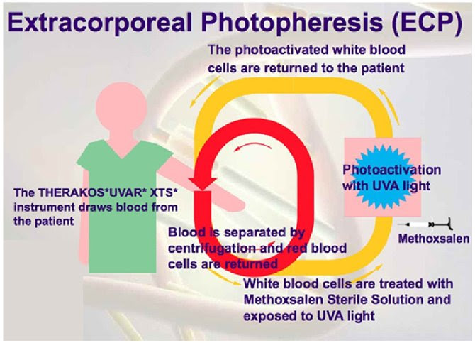 Photopheresis; Extracorporeal Photochemotherapy ...