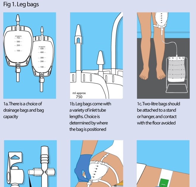 catheter
