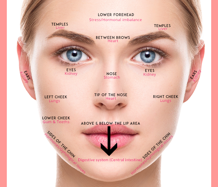 Spots on face hormonal ~ Top Secret Skin Tips