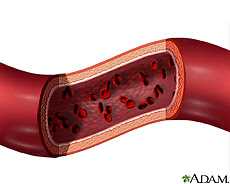 Illustration of an artery containing blood cells