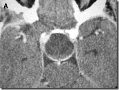 Click to enlarge figure Click to enlarge figure