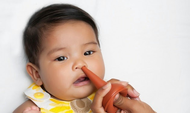 Cara Mengatasi Hidung Mampet Karena Pilek Pada Bayi  Contoh Semua 