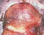 picture of cat tumor