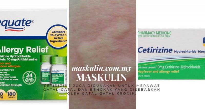 Ubat Mata Kering Dan Gatal 9 Descargar