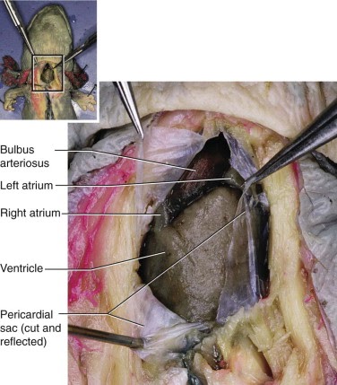 What Separates The Parietal And Visceral Pericardium - slidesharefile