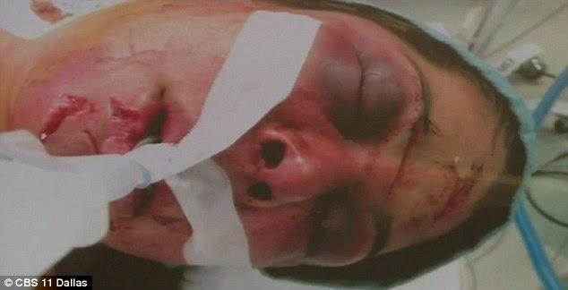 Escamilla was brutally attacked by her boyfriend Jose Arreola in March 2011 who stabbed her repeatedly (she is pictured in hospital after the assault)