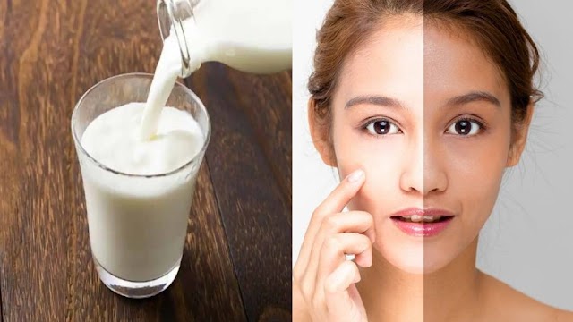 सेहत ही नहीं त्वचा के लिए भी फायदेमंद है कच्चा दूध, इस तरह करें इस्तेमाल, चमक जाएगा चेहरा