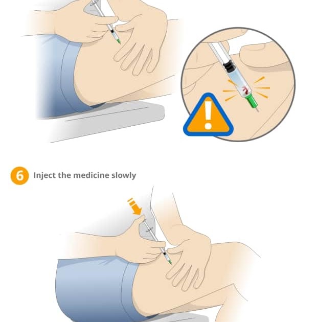 how to give yourself an im injection in the thigh