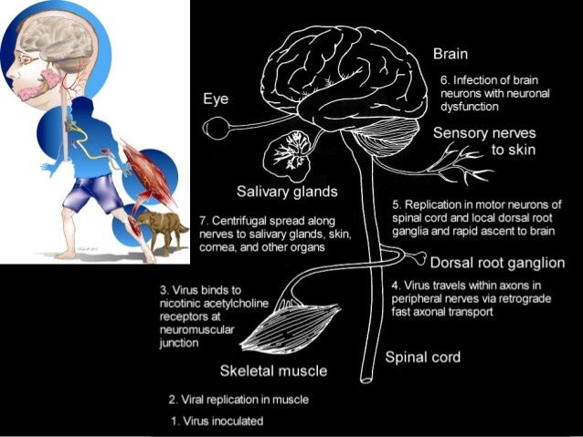 History Of Rabies Virus - Transmission and pathogenesis | Rabies