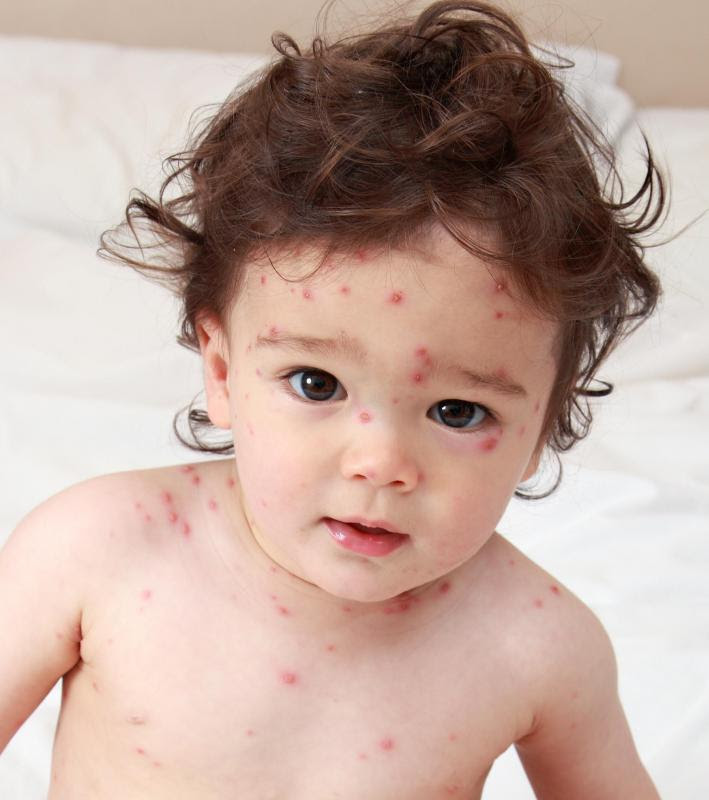 stomach-virus-symptoms-in-babies