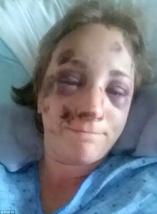Part of her ear was also torn off, however Kohnhurst has undergone surgery and is making a great recovery