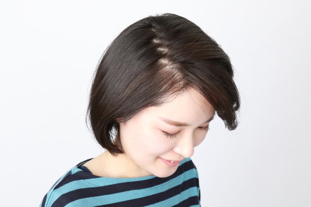 √100以上 頭頂部 はげ 髪型 女性 105307頭頂部 はげ 髪型 女性