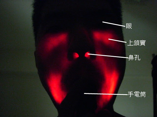 鼻竇