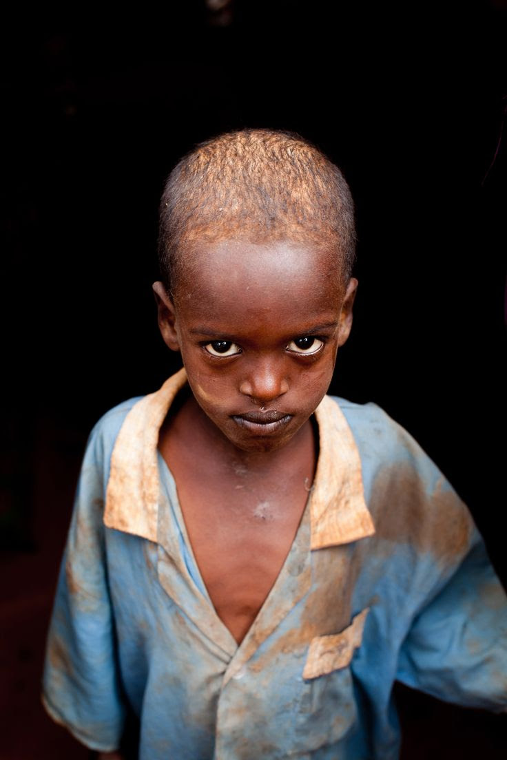 Little boy in Somalia