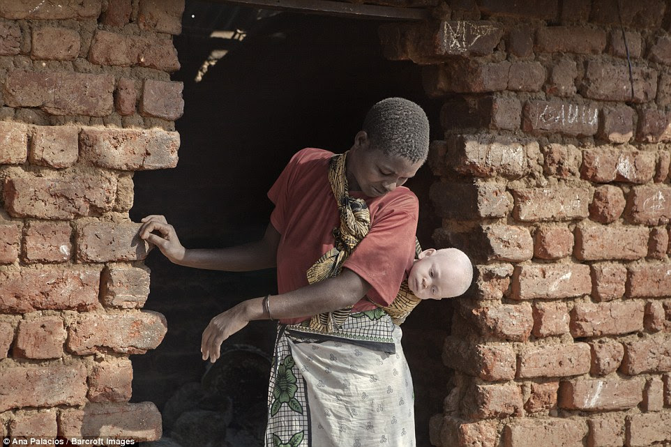 The women who flee to the centre with their albino children also act as guardians for the others who have been abandoned