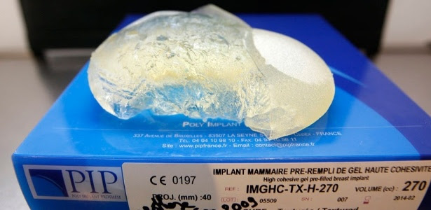 Autoridades francesas suspeitam que o gel usado na fabricação da prótese era de má qualidade