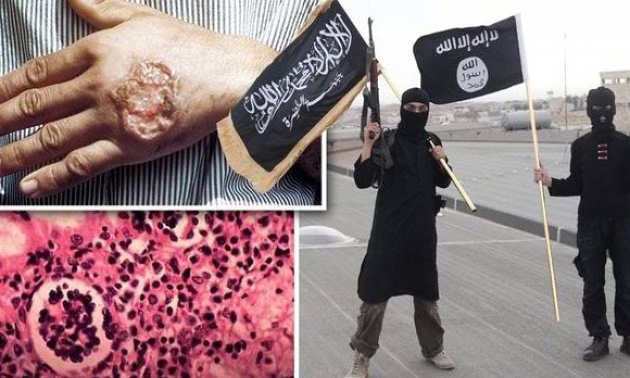 Σαρκοβόρο παράσιτο απειλεί το Ισλαμικό Κράτος   