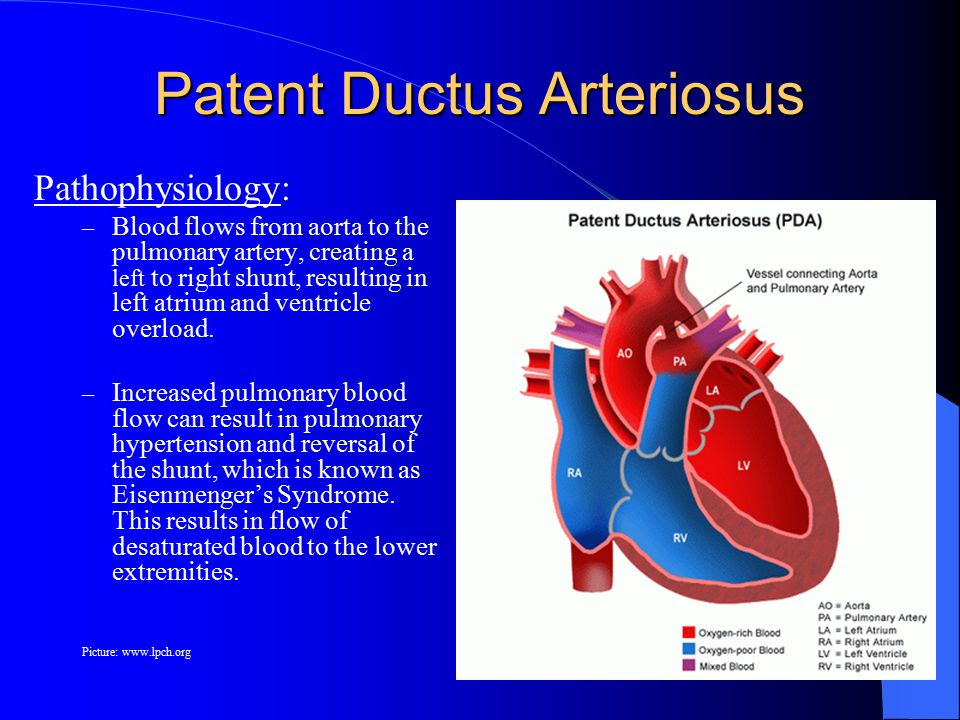 diastolic-congestive-heart-failure-signs