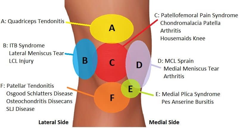 Back Diagnosis Chart