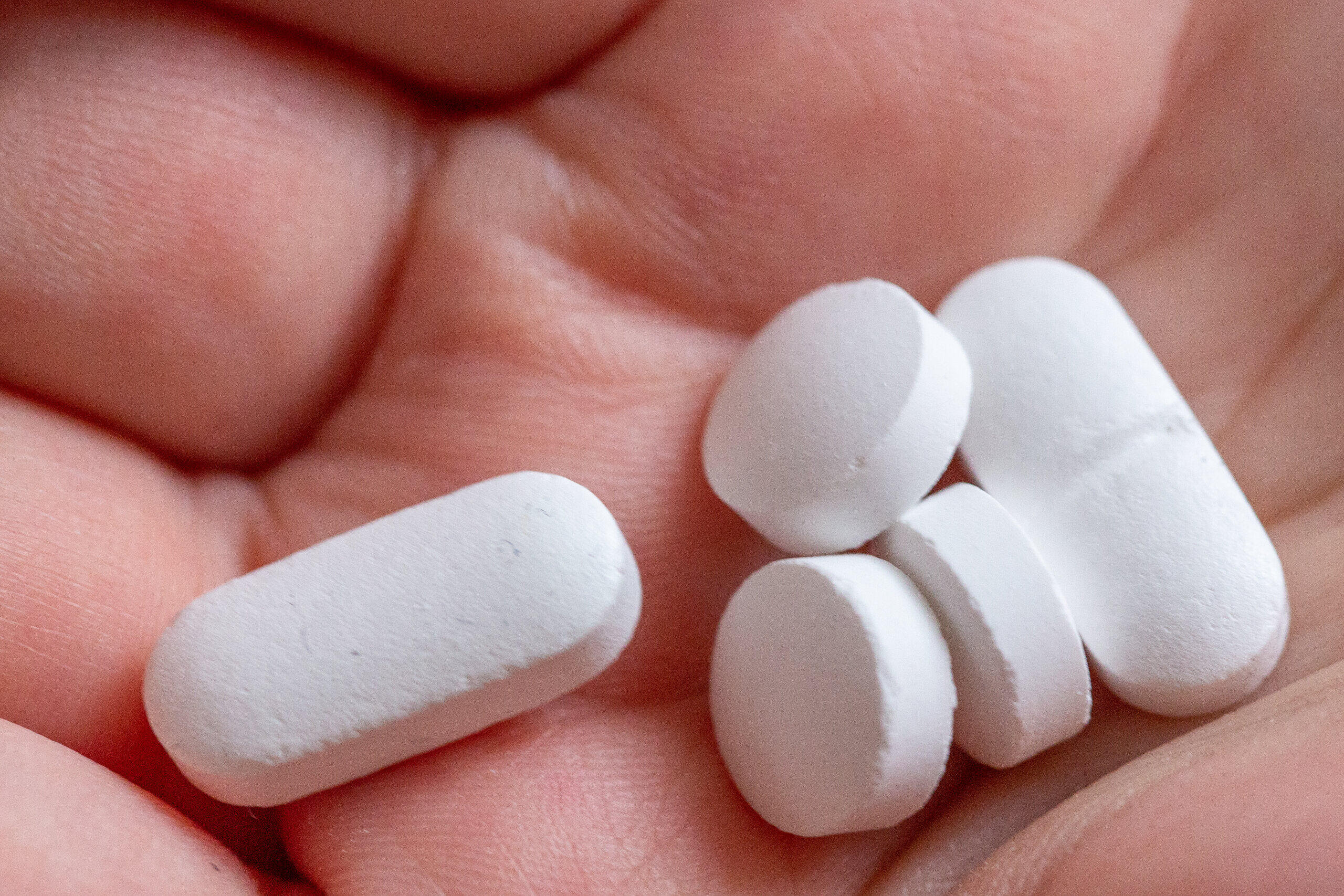 Vitamin-D-Überdosis: Wie gravierend sind die Folgen für deine Gesundheit?