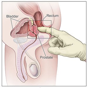 scintigrafie skeletu prostata)