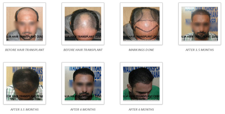 hair-gallery-img2