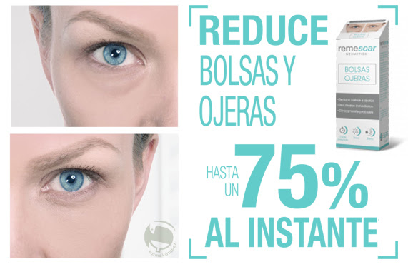 http://sufarmaciaonline.es/wp-content/uploads/2016/06/remescar-bolsas-y-ojeras.jpg