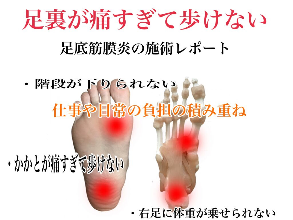 √完了しました！ 立ち 仕事 か か かかと が 痛い 痛風 295600
