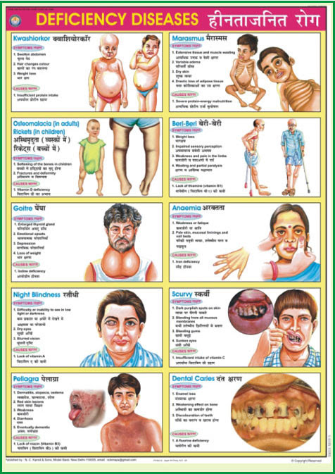 18 Unique Vitamin And Mineral Deficiency Symptoms Chart