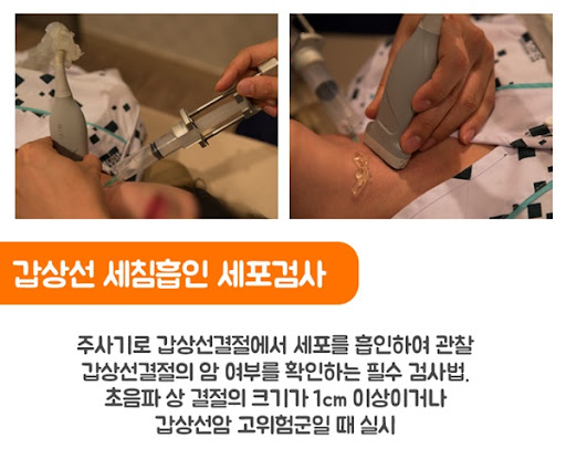 갑상선암 치료 전에 갑상선암 검사부터 조사하고 싶은 경우에는