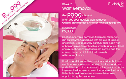 Flawless Wart Removal
