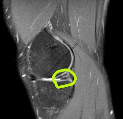 knee3.tiff