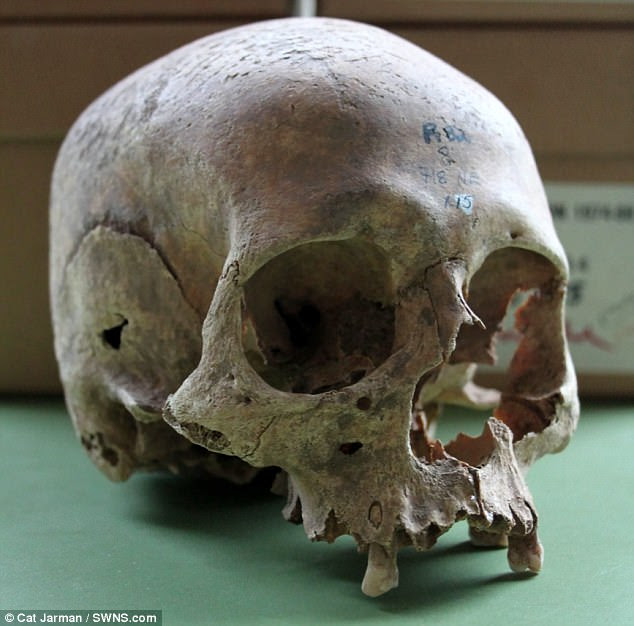 Rbecame a Viking stronghold for the army, known to the Anglo Saxons as the Great Heathen Army, after they seized it. This is one of the female skulls from the Repton charnel