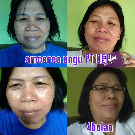 Foto Testimonial Pemakaian Amoorea Foto Testimonial Pemakaian Amoorea