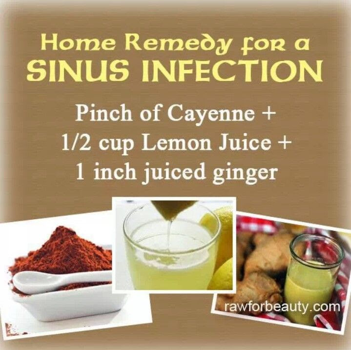 43+ Preauricular Sinus Abscess PNG