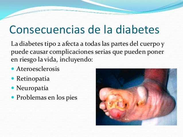 diabetes tipo 2 efectos cigarrillo salud