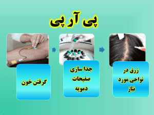 پی_آر_پی