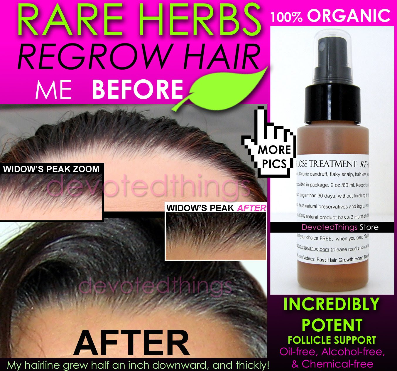 Best Treatment For Hair Growth Hairstyles Idea