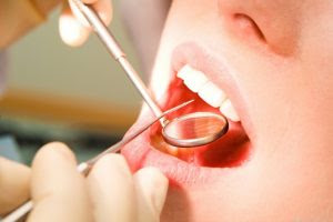 soins dentiste