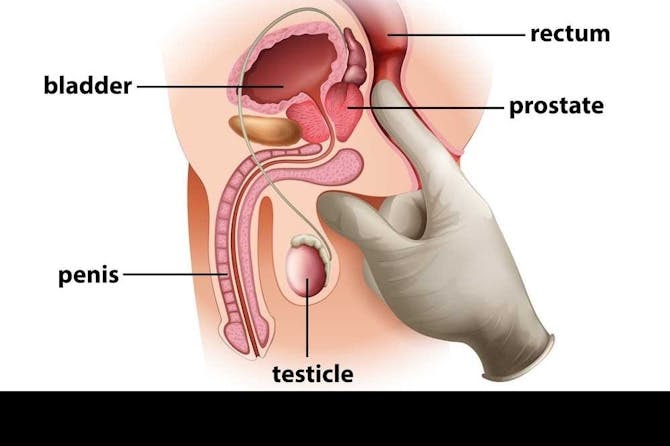 How do i know if i have an enlarged prostate