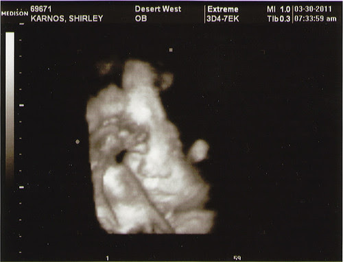 Ultrasound2011.03.30_01