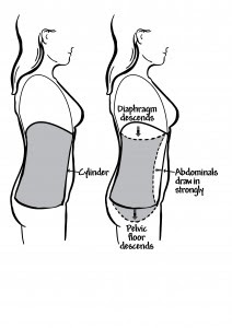 Abdominal exercises after prolapse surgery 