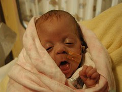Finally off oxygen! Look at my cute face!